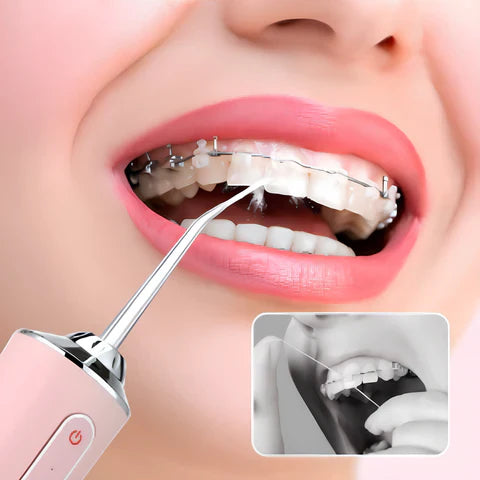 Irrigador Dental de Precisión - Recargable